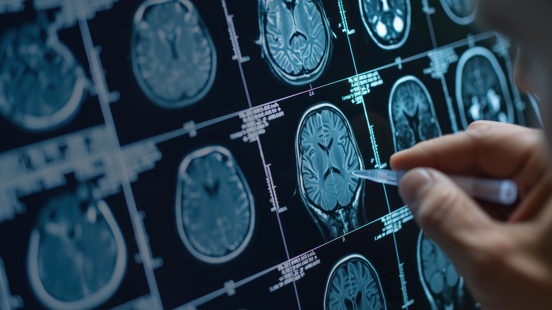Neurology Clinic Services  in NJ